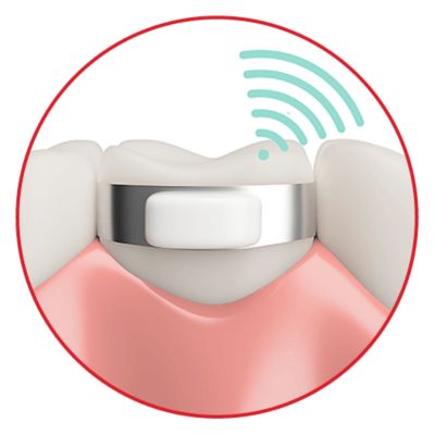 Tooth-Mounted Salivary Health Monitor Uses BG27 CSP